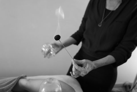 Soin thérapie ventouses